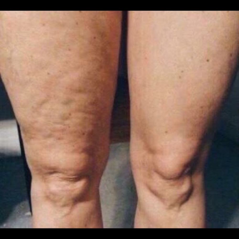 Nu Skin Dermatic Effects cellulite firming cream - Picture 5 of 16